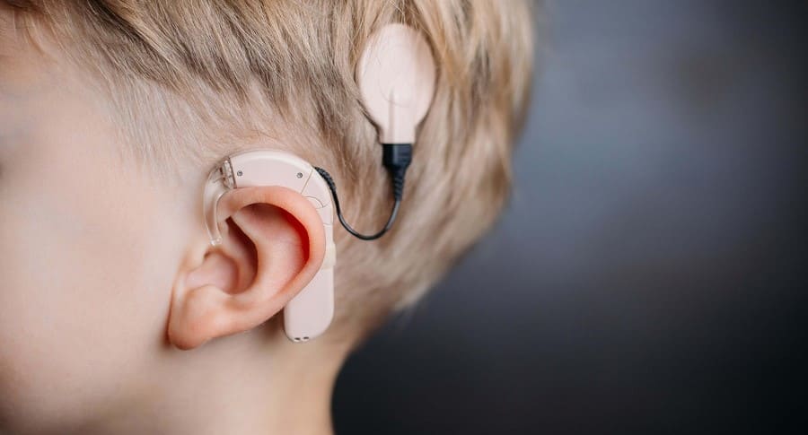 Cochlear Implant Lawsuits